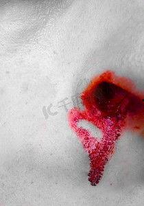 受伤流血的图片,受伤流血现场急救纪实